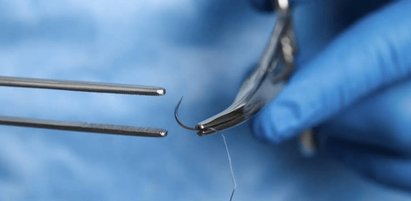 Surgical Suture Hooks: Design Considerations for Modern Medical Instruments